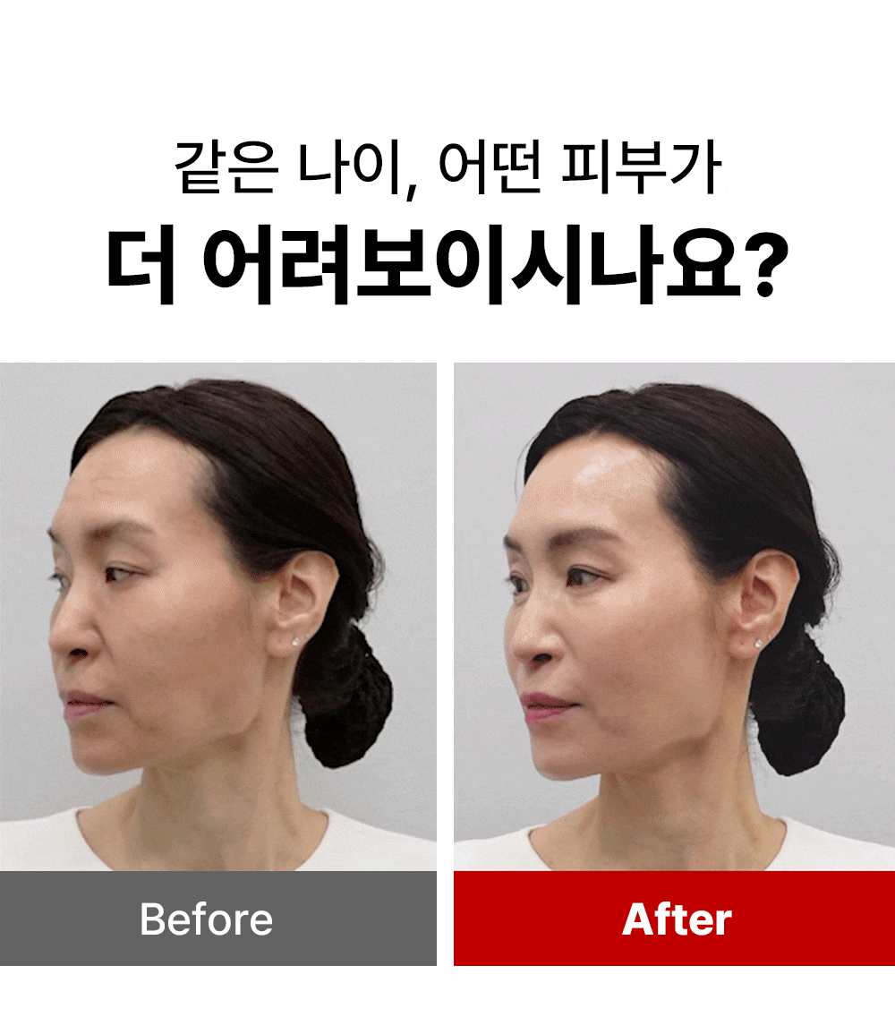 [디퍼앤디퍼]프리미엄 레드 엑소좀 스킨 부스터 2ml x 14개
