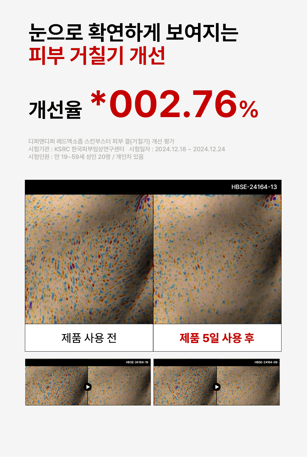 [디퍼앤디퍼]프리미엄 레드 엑소좀 스킨 부스터 2ml x 14개