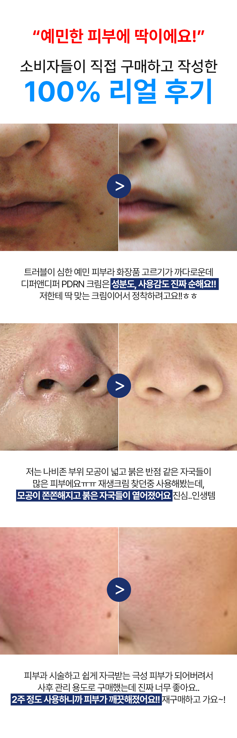 [디퍼앤디퍼]토탈 솔루션 크림 5종 택 1