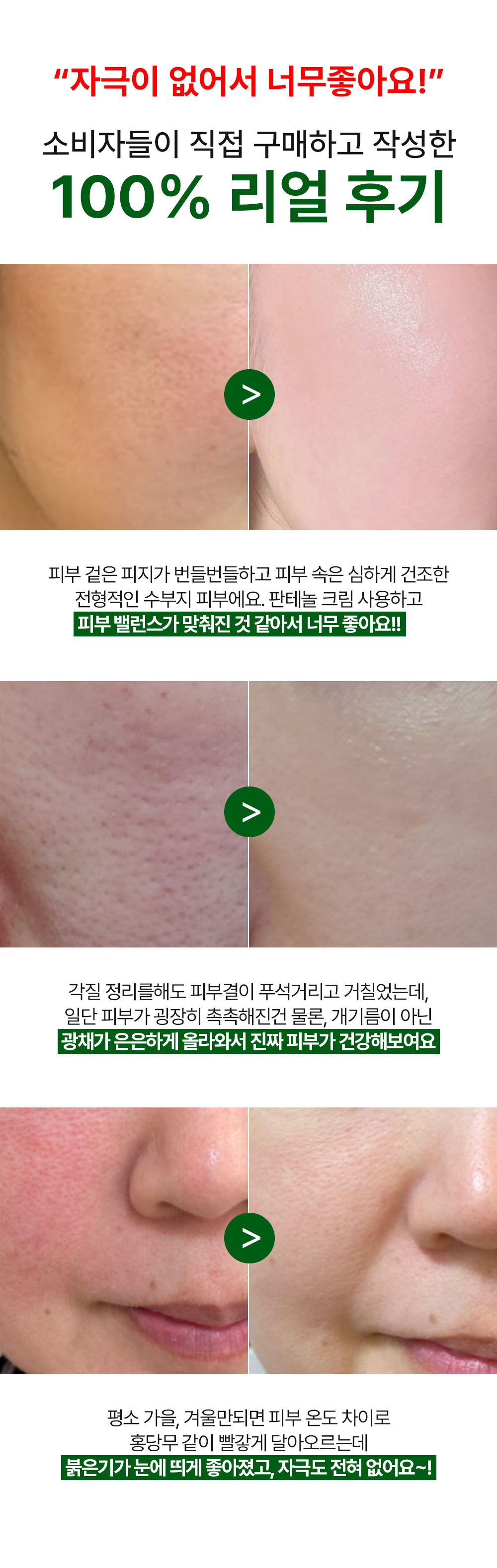 [디퍼앤디퍼]토탈 솔루션 크림 5종 택 1