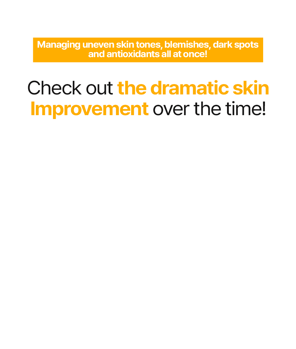 (EN)Brightening_Toning_Skinbooster_04.gif